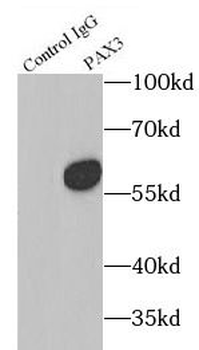 PAX3 Rabbit Polyclonal Antibody
