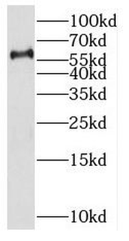 PAX3 Rabbit Polyclonal Antibody