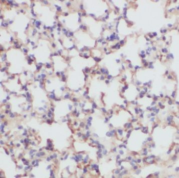 PAX3 Rabbit Polyclonal Antibody