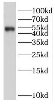 PBX1 Rabbit Polyclonal Antibody