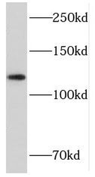CDH3 Rabbit Polyclonal Antibody