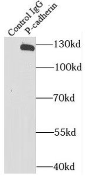 CDH3 Rabbit Polyclonal Antibody