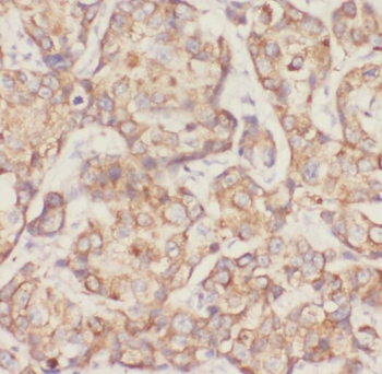 CDH3 Rabbit Polyclonal Antibody