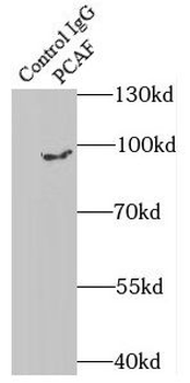 KAT2B Rabbit Polyclonal Antibody