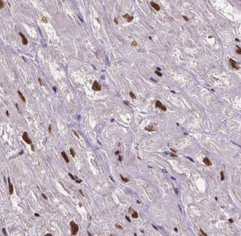 KAT2B Rabbit Polyclonal Antibody