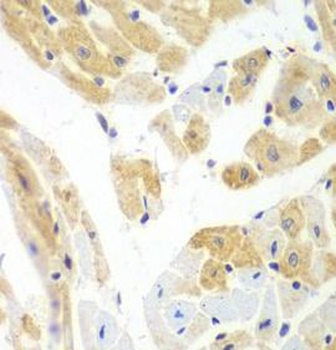 PCBP2 Rabbit Polyclonal Antibody