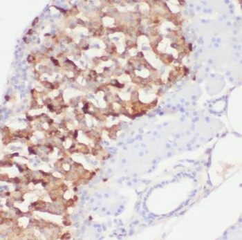 PCMT1 Rabbit Polyclonal Antibody