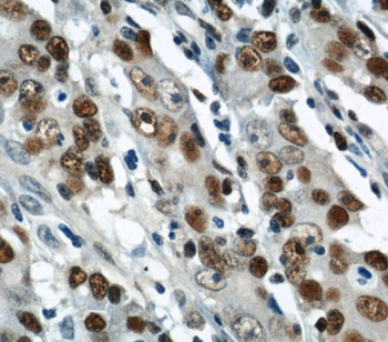 PCNA Rabbit Polyclonal Antibody