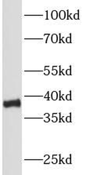 PCNA Rabbit Polyclonal Antibody