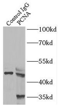 PCNA Rabbit Polyclonal Antibody