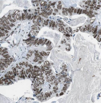 PCNA Rabbit Polyclonal Antibody
