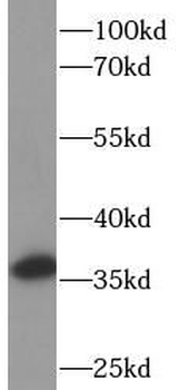 PCNA Mouse Monoclonal Antibody