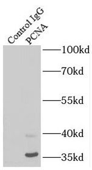 PCNA Mouse Monoclonal Antibody