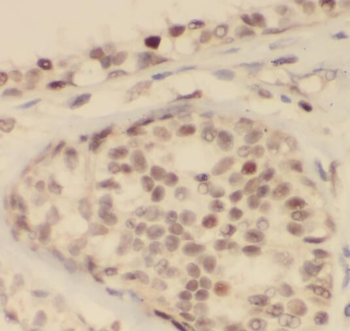 PCNA Mouse Monoclonal Antibody