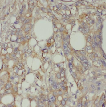 PCSK7 Rabbit Polyclonal Antibody
