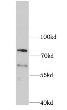 PCSK9 Rabbit Polyclonal Antibody
