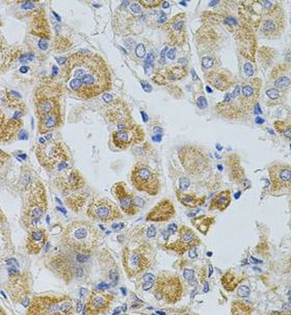 PCSK9 Rabbit Polyclonal Antibody