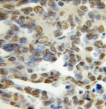 PCTP Rabbit Polyclonal Antibody