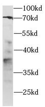 PD 1 Rabbit Polyclonal Antibody