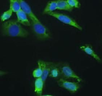 PD 1 Rabbit Polyclonal Antibody