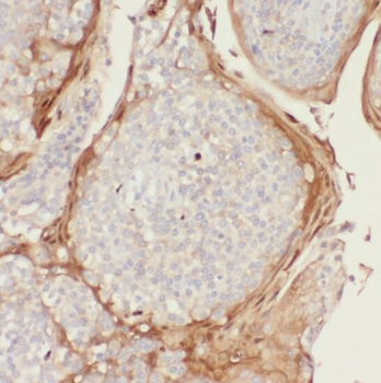 PD 1 Rabbit Polyclonal Antibody
