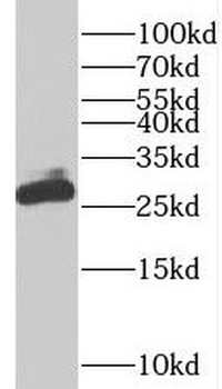 PDAP1 Rabbit Polyclonal Antibody