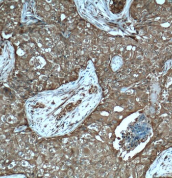 PDAP1 Rabbit Polyclonal Antibody