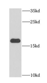 PDCD6 Rabbit Polyclonal Antibody