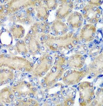 PDCD6 Rabbit Polyclonal Antibody