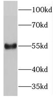 PDCD7 Rabbit Polyclonal Antibody