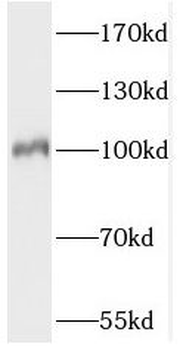 PDE5A Rabbit Polyclonal Antibody