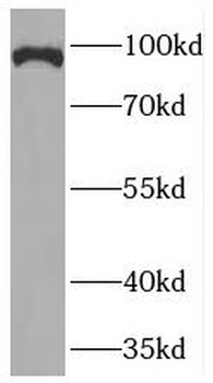 PDE8A Rabbit Polyclonal Antibody
