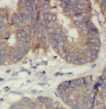 PDE8A Rabbit Polyclonal Antibody