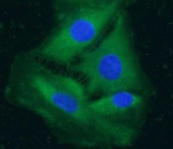 PDE9A Rabbit Polyclonal Antibody