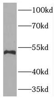 TYMP Rabbit Polyclonal Antibody