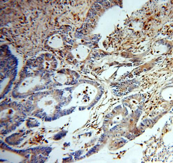 TYMP Rabbit Polyclonal Antibody