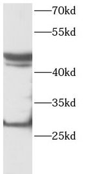 PDGFD Rabbit Polyclonal Antibody