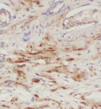 PDGFD Rabbit Polyclonal Antibody