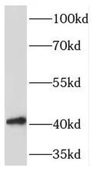 PDGFRL Rabbit Polyclonal Antibody