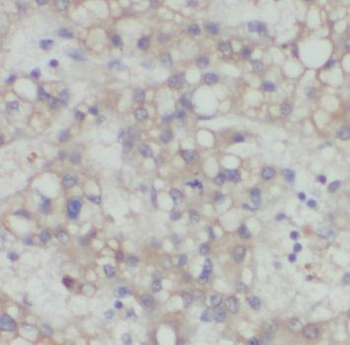 PDGFRL Rabbit Polyclonal Antibody