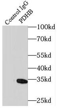 PDHB Rabbit Polyclonal Antibody