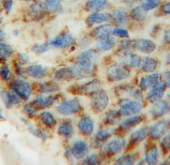 PDHB Rabbit Polyclonal Antibody