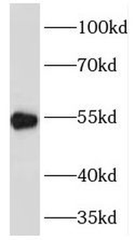 PDHX Rabbit Polyclonal Antibody