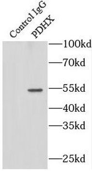 PDHX Rabbit Polyclonal Antibody