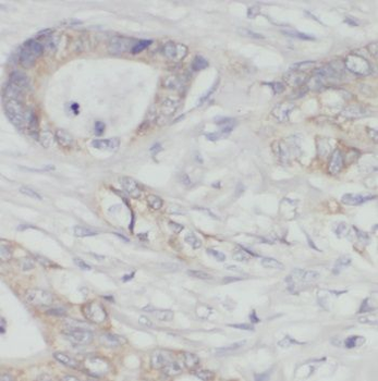 PDHX Rabbit Polyclonal Antibody