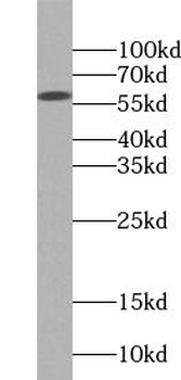 P4HB Rabbit Polyclonal Antibody