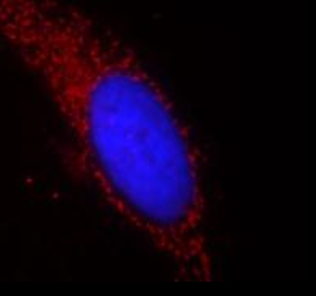 P4HB Rabbit Polyclonal Antibody