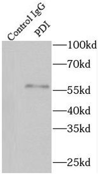 P4HB Rabbit Polyclonal Antibody