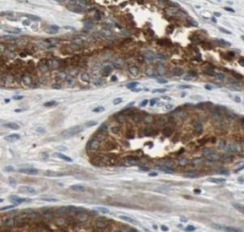 P4HB Rabbit Polyclonal Antibody