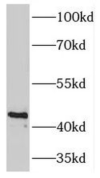 PDK2 Rabbit Polyclonal Antibody